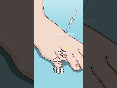 Thumbnail for Mending Toes: A Doctor's Approach to Brachydactyly#animation #funny #shorts #health - video