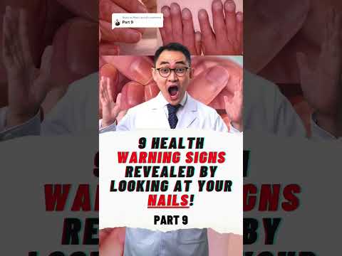 Thumbnail for 9 HEALTH WARNING SIGNS REVEALED BY LOOKING AT YOUR NAILS! #shorts - video